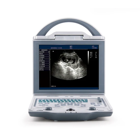 Rilevatore di ultrasuoni portatile digitale prenatale per uso domestico per donne, cardiofrequenzimetro fetale Doppler per neonati